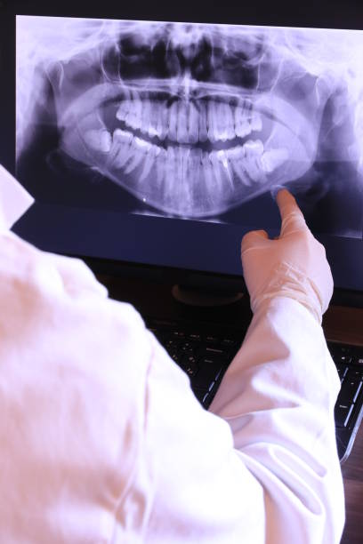 Best Emergency Broken Tooth Repair in Harrisonburg, VA