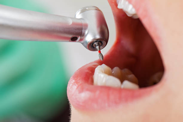 Best After-Hours Emergency Dentist in Harrisonburg, VA
